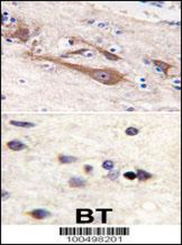 VILIP1 Antibody (C-term)