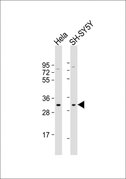 Connexin 31 Antibody (C-term)