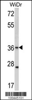 Connexin 31 Antibody (C-term)
