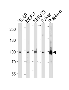 STAT5b Antibody (C-term)