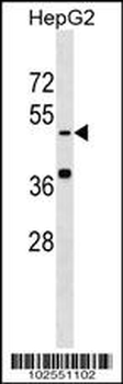 Kremen Antibody (N-term)