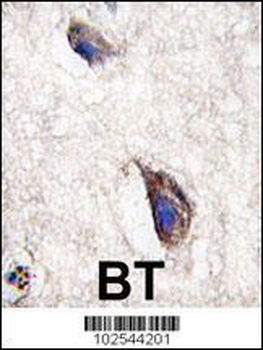 DKK3 Antibody (N-term)