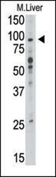 TLR6 Antibody (C-term)