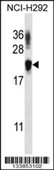 TTC33 Antibody