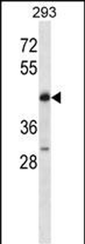POU4F2 Antibody (C-term)