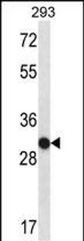 OR4K14 Antibody (N-term)