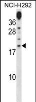 PRR15 Antibody (C-term)