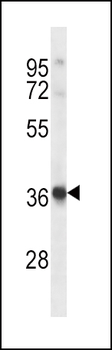 HRH2 Antibody (Center)