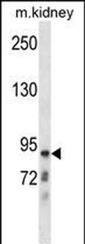 CLCNKB Antibody (N-term)