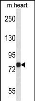 Mouse Map4k2 Antibody (Center)