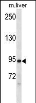 Mouse Dclk1 Antibody (N-term)