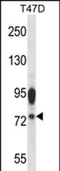 AMFR Antibody (Center)