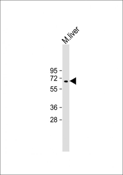 Mouse Camkk2 Antibody (N-term)
