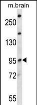 NEDD4L Antibody (Center)