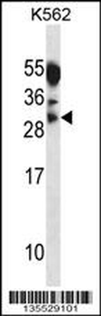 MYOG Antibody (Center)