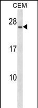 CD79A Antibody (Center)
