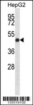 IHH Antibody (N-term)