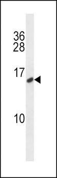CALCA/CT Antibody (C-term)