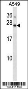 Mouse Hoxb7 Antibody (Center)