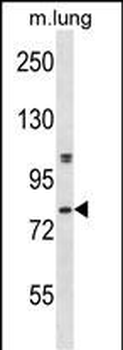 Mouse Dyrk4 Antibody (C-term)