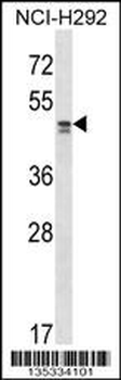 TADA2L Antibody (Center)