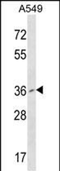 PCGF2 Antibody (Center)