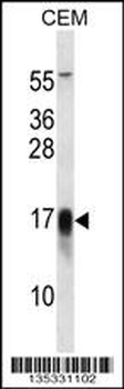 FXYD5 Antibody (Center)