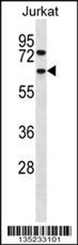 CCT4 Antibody (N-term)