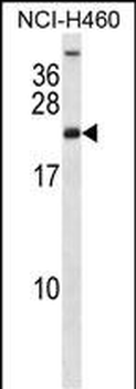 RPS16 Antibody (Center)