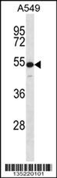 KRT7 Antibody (N-term)
