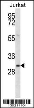 TMED8 Antibody (Center)
