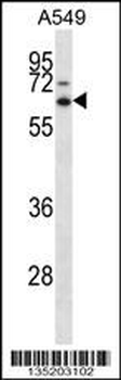 ZSCAN22 Antibody (Center)