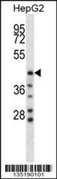 HYAL1 Antibody (C-term)