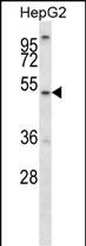 ALG11 Antibody (C-term)