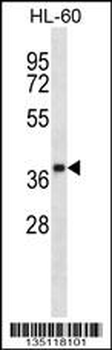 OR5F1 Antibody (C-term)