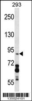 DDX20 Antibody (C-term)