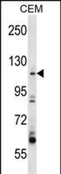 ARHGEF1 Antibody (N-term)