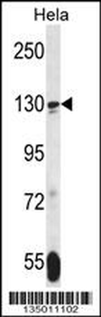 TNKS Antibody (N-term)