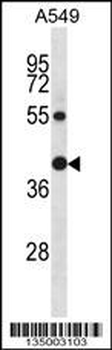 RAD23B Antibody (N-term)