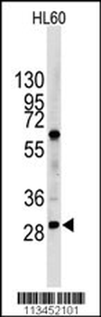 LIN28B Antibody (N-term)