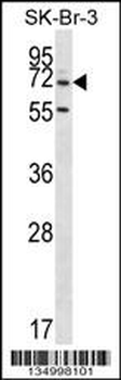 ZNF398 Antibody (Center)