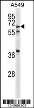 GLP2R Antibody (Center)
