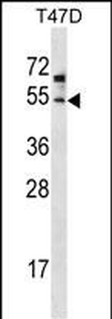 ZDHHC6 Antibody (C-term)