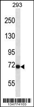 Mouse Fgfr3 Antibody (Center)
