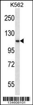 PCSK6 Antibody (C-term)