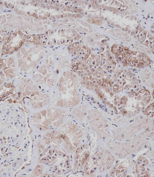 CD9 Antibody (Center)