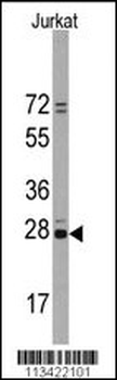 CD9 Antibody (N-term)