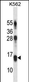 LY86 Antibody (C-term)