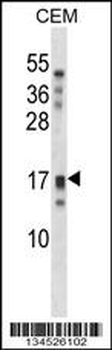 KLK15 Antibody (Center)