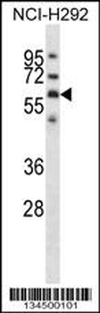 GPC3 Antibody (C-term)